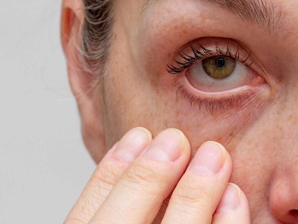 Olhos secos na menopausa? Alterações hormonais podem explicar o problema